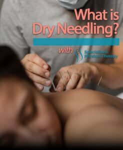 Dry Needling