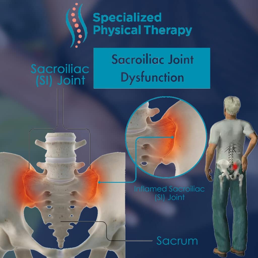 Sacroiliac Joint Pain